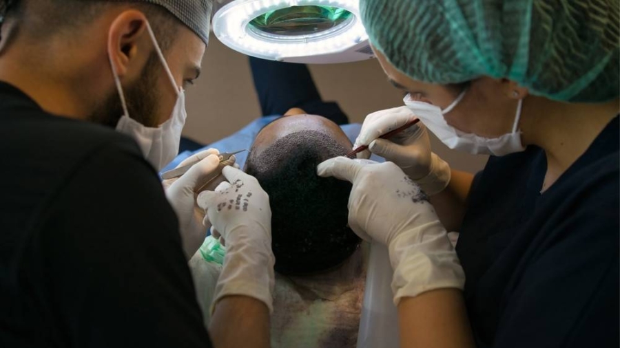 hair transplant05