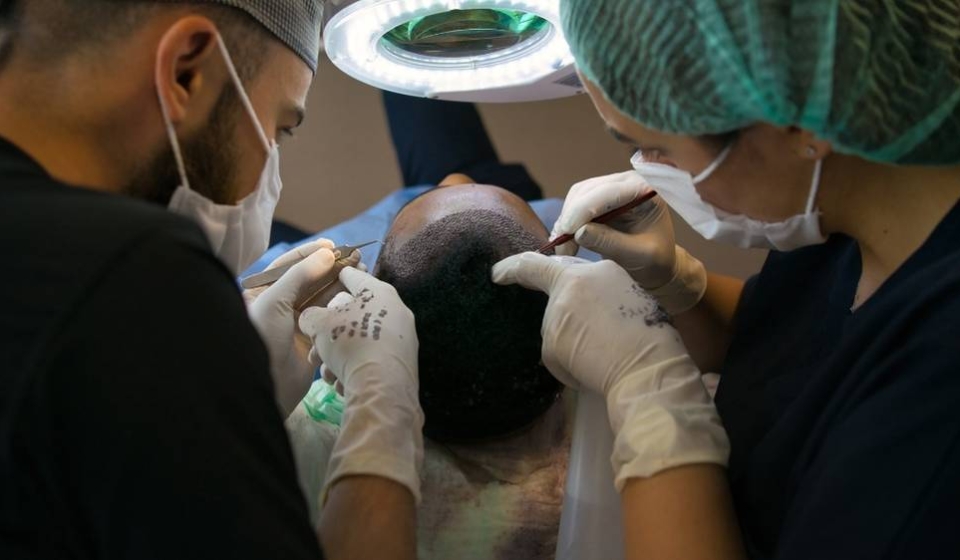 hair transplant05